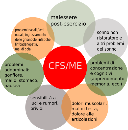 Una infografica riassuntiva della CFS/ME, sintomi che coinvolgono le attività cerebrali , il dolore ed il sonno.